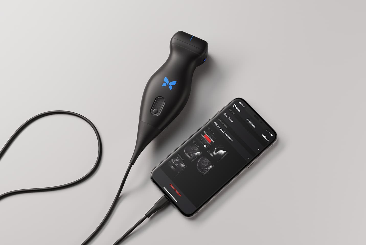 Butterfly iQ ultrasound image