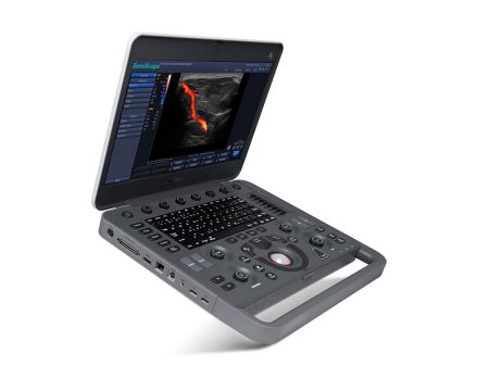 SonoScapeX5 ultrasound machine