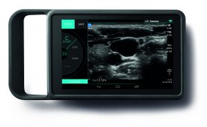 sonosite iviz ultrasound machine image