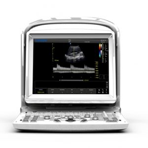 Chison ECO 3 image