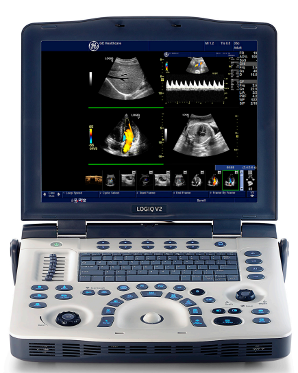 GE Logiq V2 Ultrasound Machine
