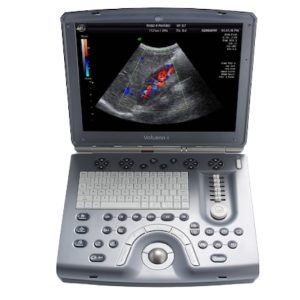 GE Voluson i ultrasound