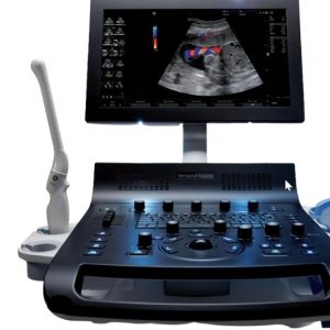 Used GE Versana Essential Cardiac Ultrasound Machine For Sale From ...