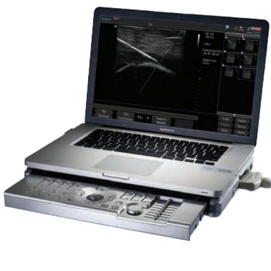 Terason t3200 ultrasound machine