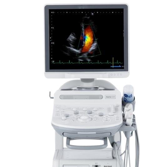 Toshiba Xario 100 ultrasound machine on a cart