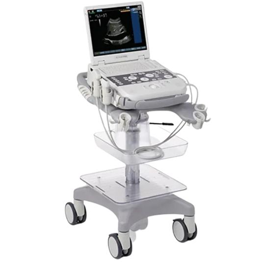Siemens Acuson P300 ultrasound machine on a cart