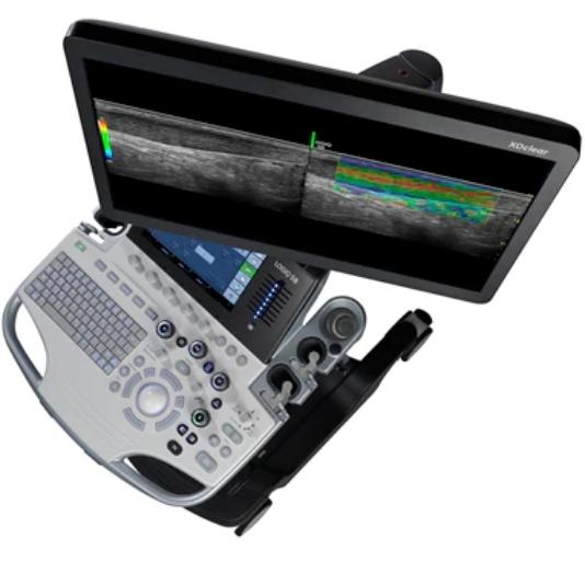 GE LOGIQ S8 R2 ultrasound machine