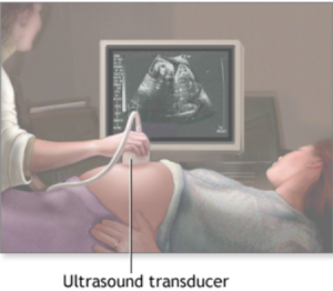 Ultrasound transducer drawing