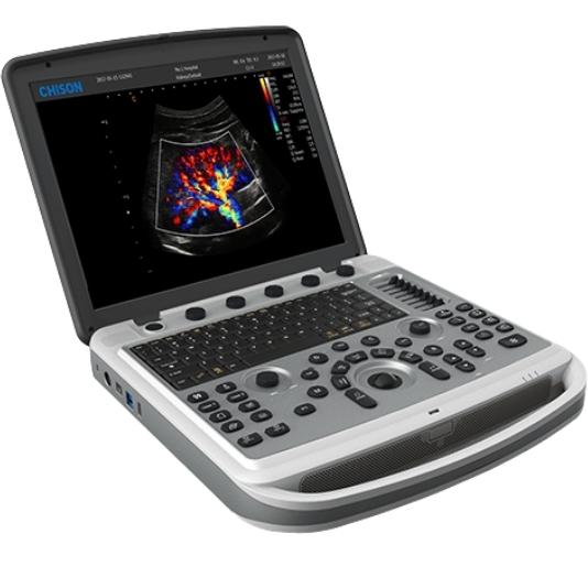 Chison SonoBook 6 ultrasound machine