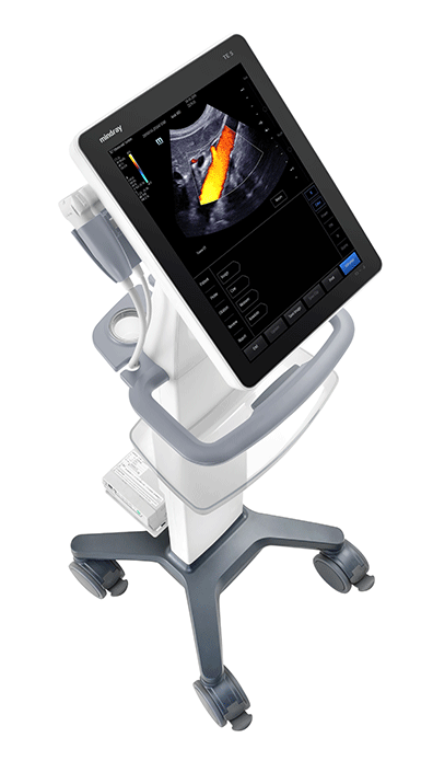 Mindray TE5 ultrasound machine on a cart