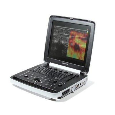 Samsung HM70 EVO Portable Ultrasound Machine